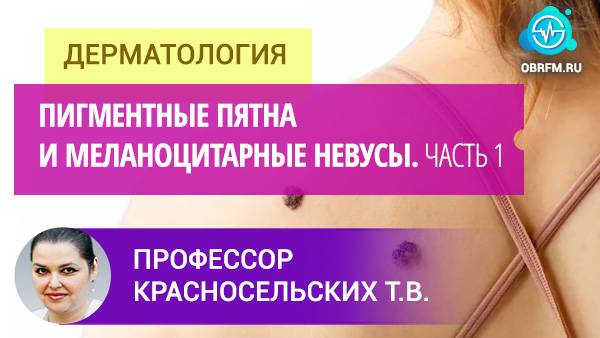 Профессор Красносельских Т.В.: Пигментные пятна и меланоцитарные невусы. Часть 1 смотреть онлайн
