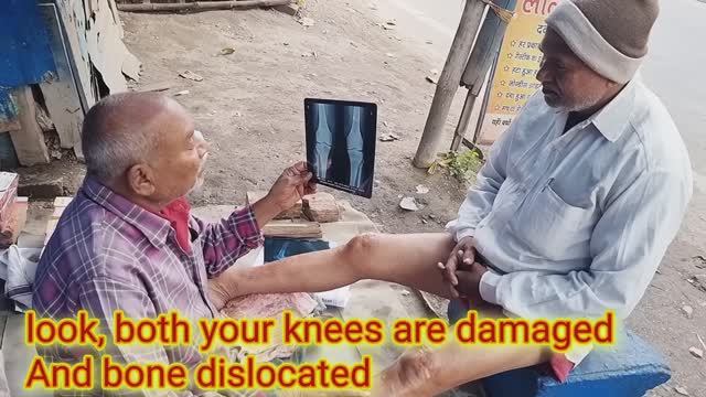 Индийский уличный лекарь, массаж ног , выравнивание колена и установка костей с дымчатым маслом смотреть онлайн