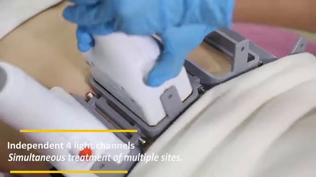 CarverShape 1060nm Diode Laser Body Contouring Permanent Fat-Melting Machine смотреть онлайн
