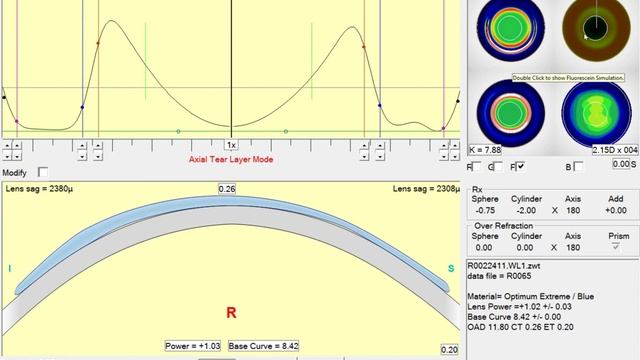 Legacy WAVE - Reducing IC Seal for Astigmatism смотреть онлайн