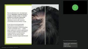 Гирудотерапия в трихологии. Пиявки при выпадении волос. Фрагмент вебинара