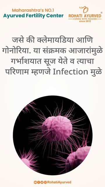 #Fallopiantube deformity - बीज वाहिनी विकृती #Fallopiantubeblock #RohatiAyurved смотреть онлайн