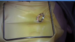 Латеральная конденсация канала 25 зуба. Скорость 7х.