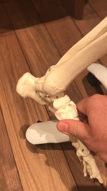 Плоскостопие. Упражнения и причины смотреть онлайн