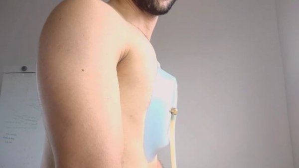 Vacuum Bell Exercise for Pectus Excavatum?