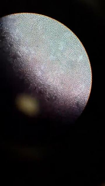 trypanosoma cruzi 10x enfermedad de chagas смотреть онлайн