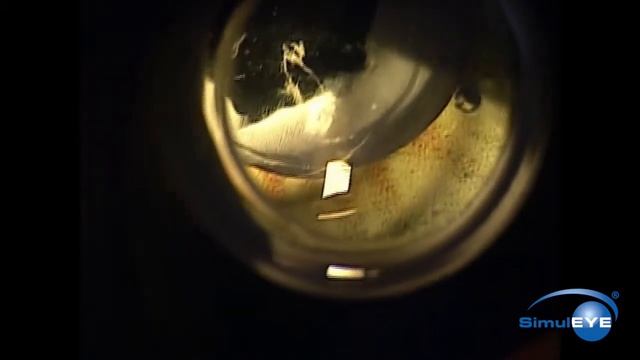 SimulEYE YAG Capsulotomy смотреть онлайн