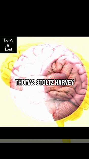 Truth story of Einstein's eye ball in tamil#shorts смотреть онлайн