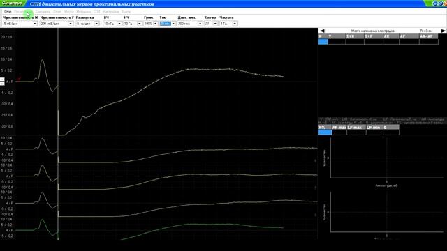 Обзорное видео по работе с миографом смотреть онлайн