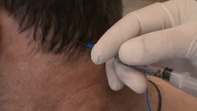 Прибор МИСТ. Обучающее видео. Нейротех смотреть онлайн