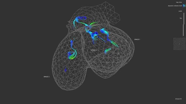 ROOGOTFL : Fraction Top - Dynamic Connections смотреть онлайн