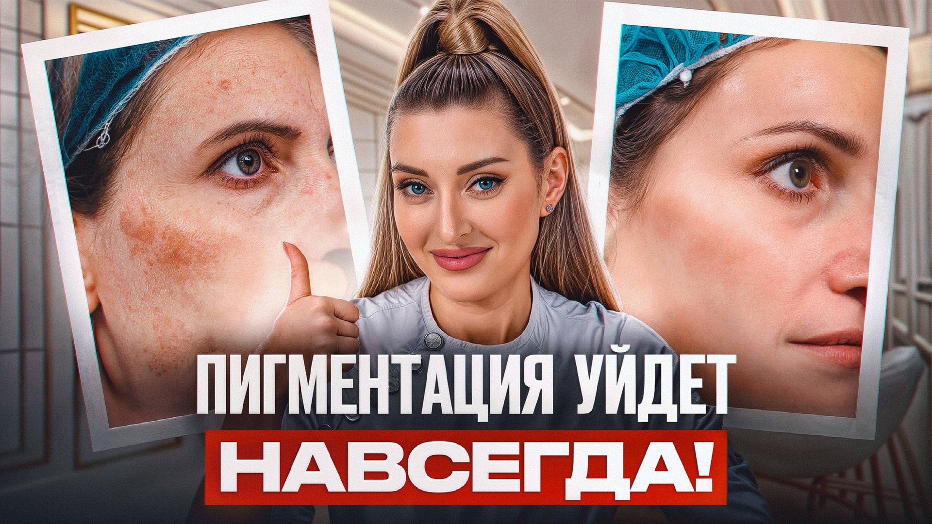 САМЫЕ эффективные способы удаления пигментации! / Как ИЗБАВИТЬСЯ от пигментных пятен? смотреть онлайн