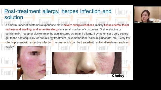 allergy after co2 fractional laser treatment | how to solve the skin reaction after co2 traetment смотреть онлайн