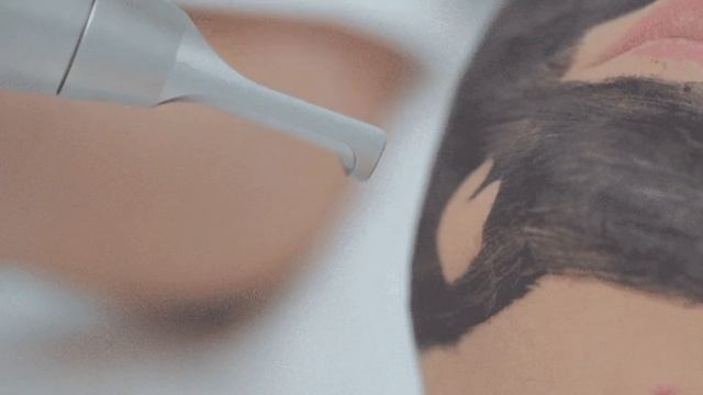 Laser Treatment For Skin Whitening| Cost of Laser Treatment in India| Side Effect of Laser Treatmen смотреть онлайн