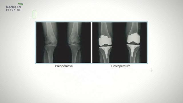 Ю. Корея. Nanoori Hospital. Презентация. смотреть онлайн