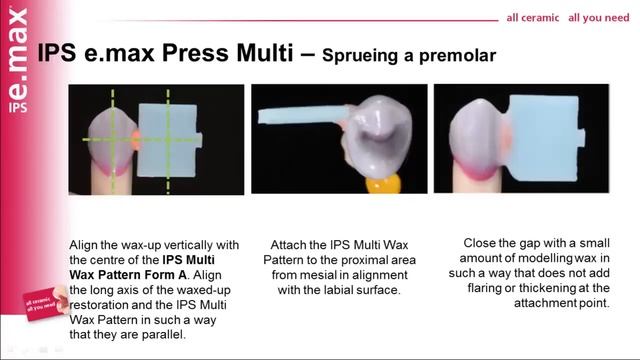 Emax Press Multi - Introducing IPS e max® Press Multi press ceramic смотреть онлайн