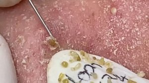 Enjoy Every Day With The Best Video Loan Nguyen Spa Official  2317