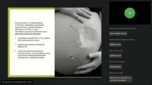 Гирудотерапия против бесплодия и при планировании беременности. Фрагмент вебинара