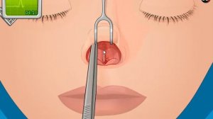 ОПЕРАЦИЯ НОСА