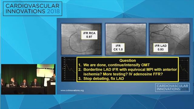 CVI2018 Session: My Best Case of the Year - Yader Sandoval, MD смотреть онлайн