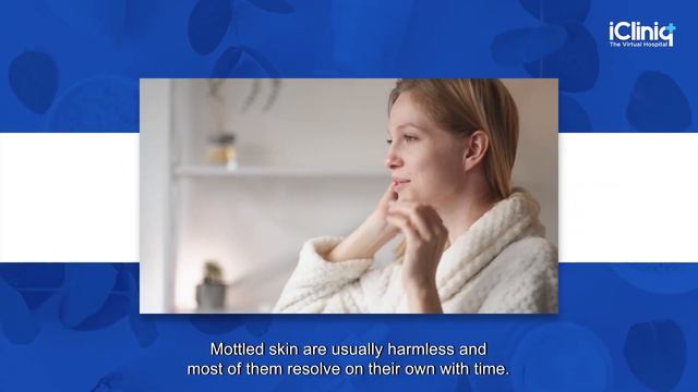 6 simple ways how you can treat your mottled skin. Causes and prevention #skincare #dermatology смотреть онлайн