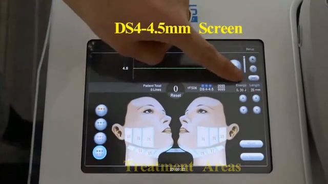 MINI HIFU MachineZS4-5 смотреть онлайн