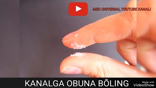 MALOCHNITSA HAQIDA MA'LUMOT. MALOCHNITSA XAVFLI KASALLIKMI? KANDIDOZ HAQIDA MA'LUMOT. #MALOCHNITSA