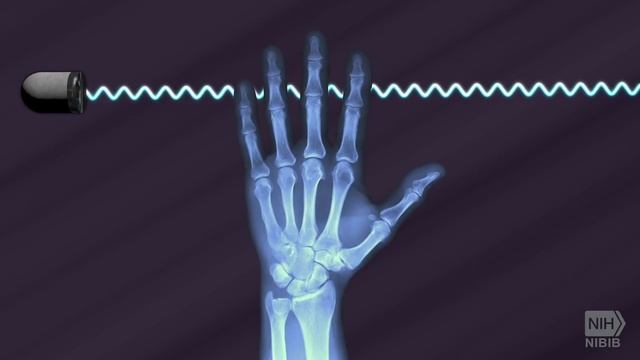 How Does a CT Scan Work смотреть онлайн