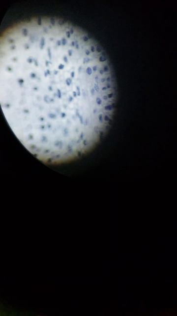 Onion Root Mitosis смотреть онлайн