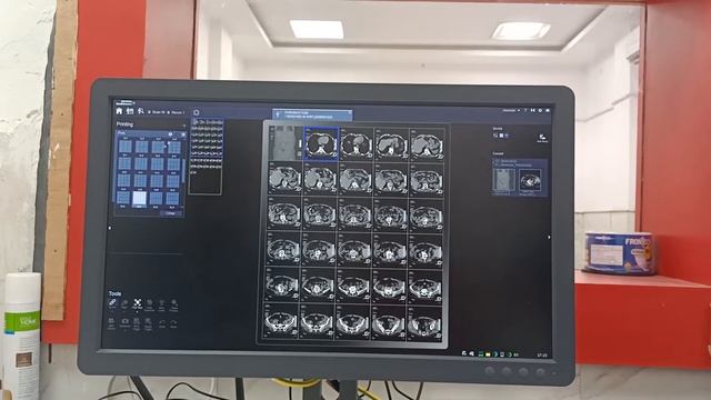 Siemens CT Scan Machine Part - 3 смотреть онлайн