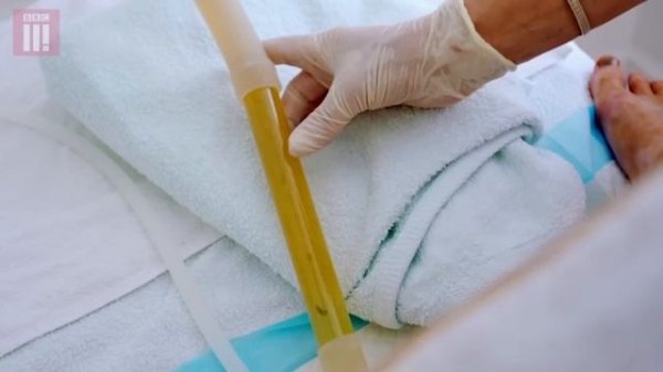 The Weird World of Colonic Irrigation Hydrotherapy: My First Time