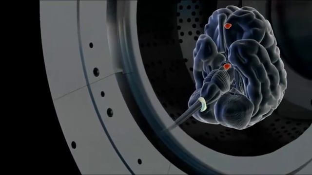 Gamma Knife смотреть онлайн