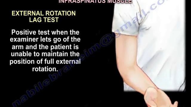 Rotator Cuff Muscle Examination - Everything You Need To Know - Dr. Nabil Ebraheim смотреть онлайн