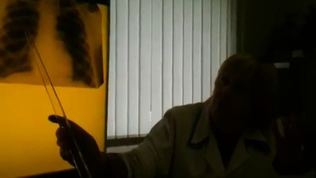 Фтизиятрии X-Ray (31) смотреть онлайн