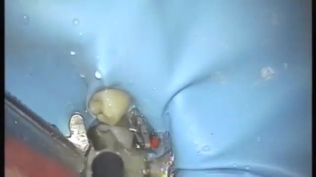 DR ARRABAL, DENTAL MICROSCOPE смотреть онлайн