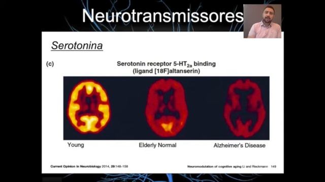 AULA 6: Fisiologia do Envelhecimento e Sistema Nervoso смотреть онлайн