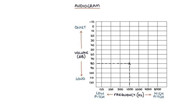 Understanding Audiometry and Audiograms смотреть онлайн
