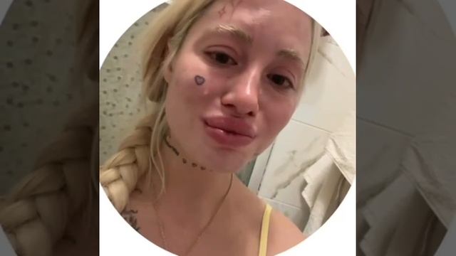 Перекосило лицо: звезда «Пацанок» Анна Михеева стала жертвой косметолога смотреть онлайн