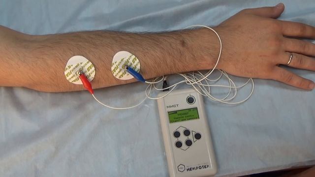 Описание портативного БОС-тренажера "МИСТ". Пример использования аппарата. смотреть онлайн