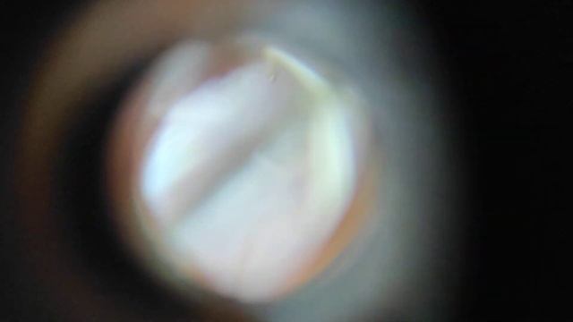 комар под микроскопом! смотреть онлайн