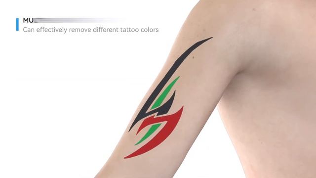 Pico laser for tattoo removal in 2021 смотреть онлайн