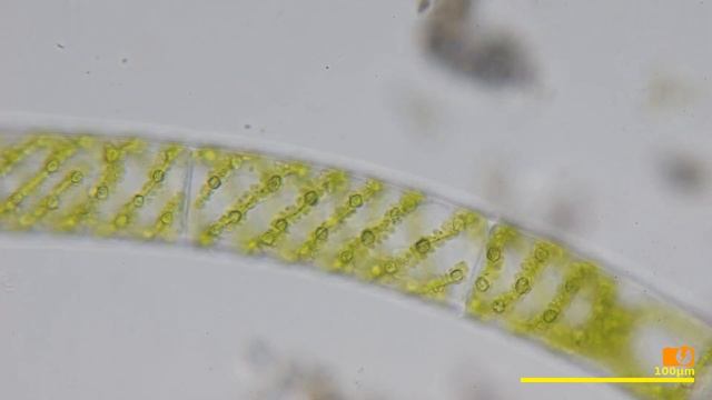 Spirogyra - Under the Microscope смотреть онлайн