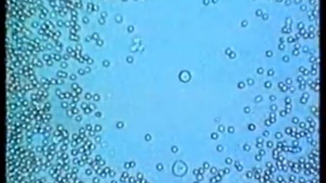 Querschnitte : Angriff aus dem Mikrokosmos 2-3 смотреть онлайн