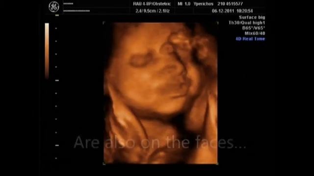 ultrasound 3D/4D.VOB смотреть онлайн