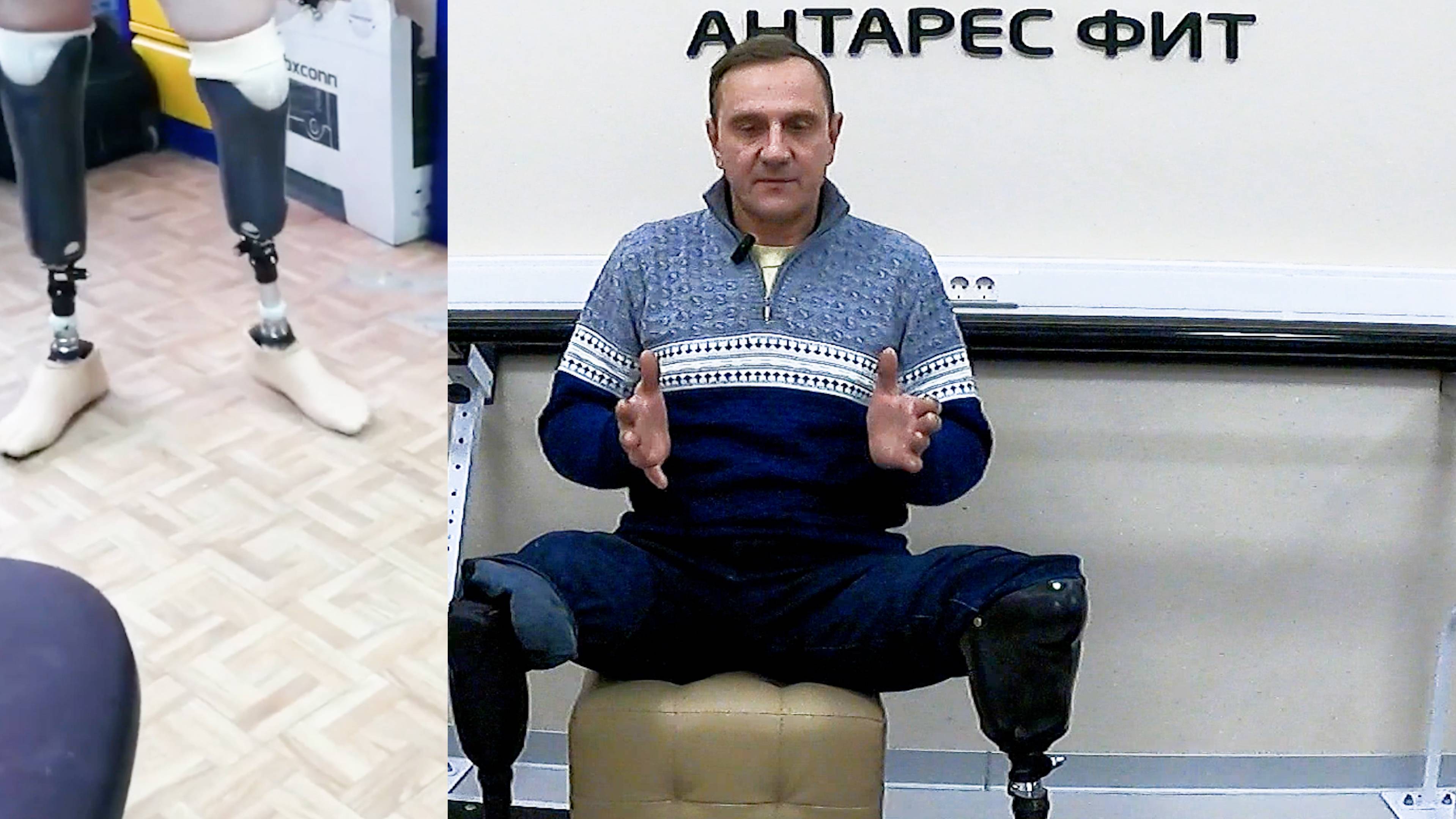 Стопы для протезов ног в мастерской "Антарес Фит" смотреть онлайн