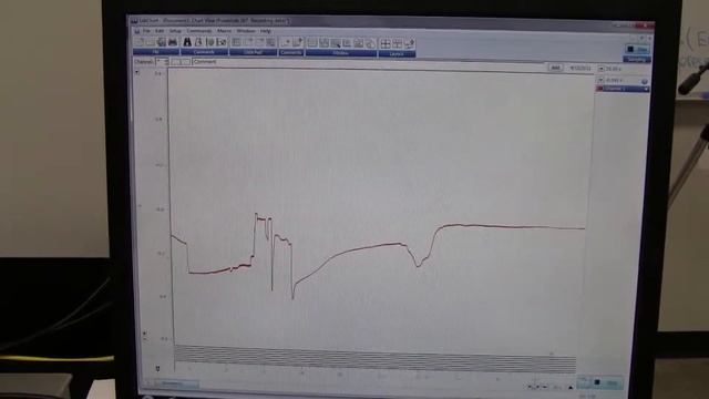 Recording ERG - Recording смотреть онлайн