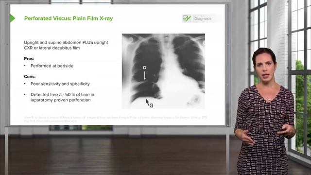 4.02 Perforated Viscus- Diagnosis смотреть онлайн
