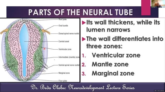 DEVELOPMENT OF THE CNS PART II - SPINAL CORD DEVELOPMENT & SPINAL DYSRAPHIC DISORDERS смотреть онлайн