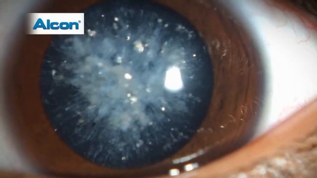 Dlaczego nie powinno się zwlekać z podjęciem decyzji o zabiegu смотреть онлайн