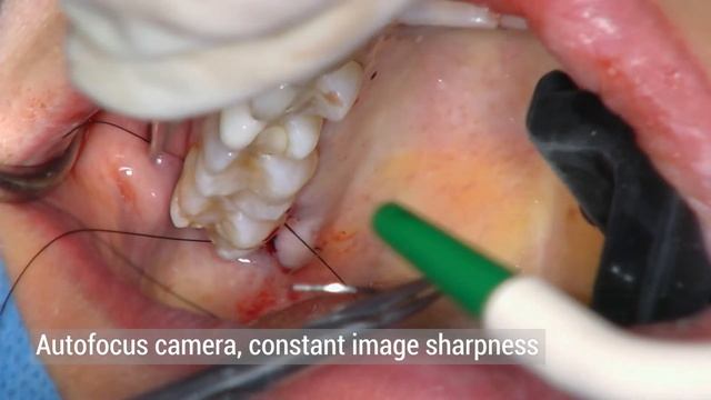 EKLER - ELIO HD смотреть онлайн